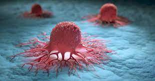 Cancer vanishes for every patient in drug trial - First time in history'